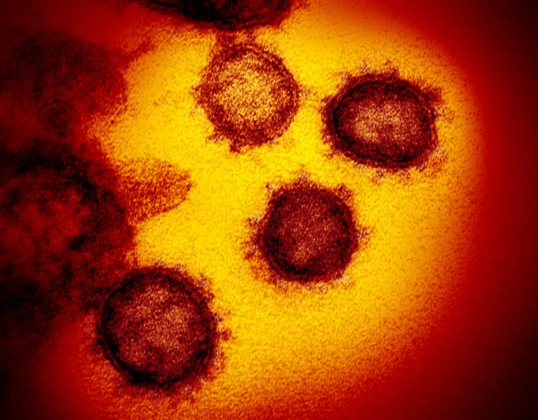 Causal sequences of Covid-19